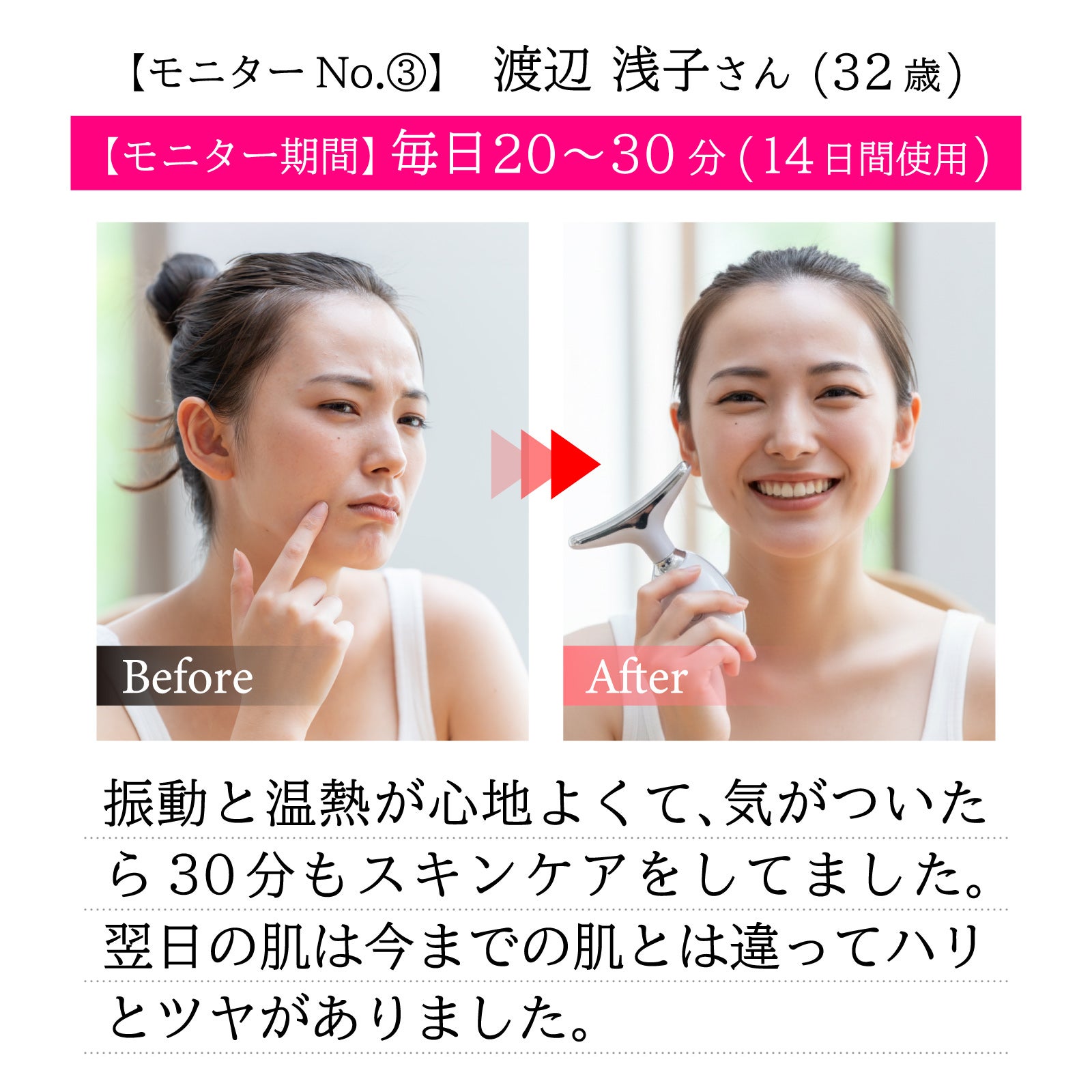 最新型 1年間保証付き｢イリス セブン プロ 小顔 美顔器｣ | 【公式